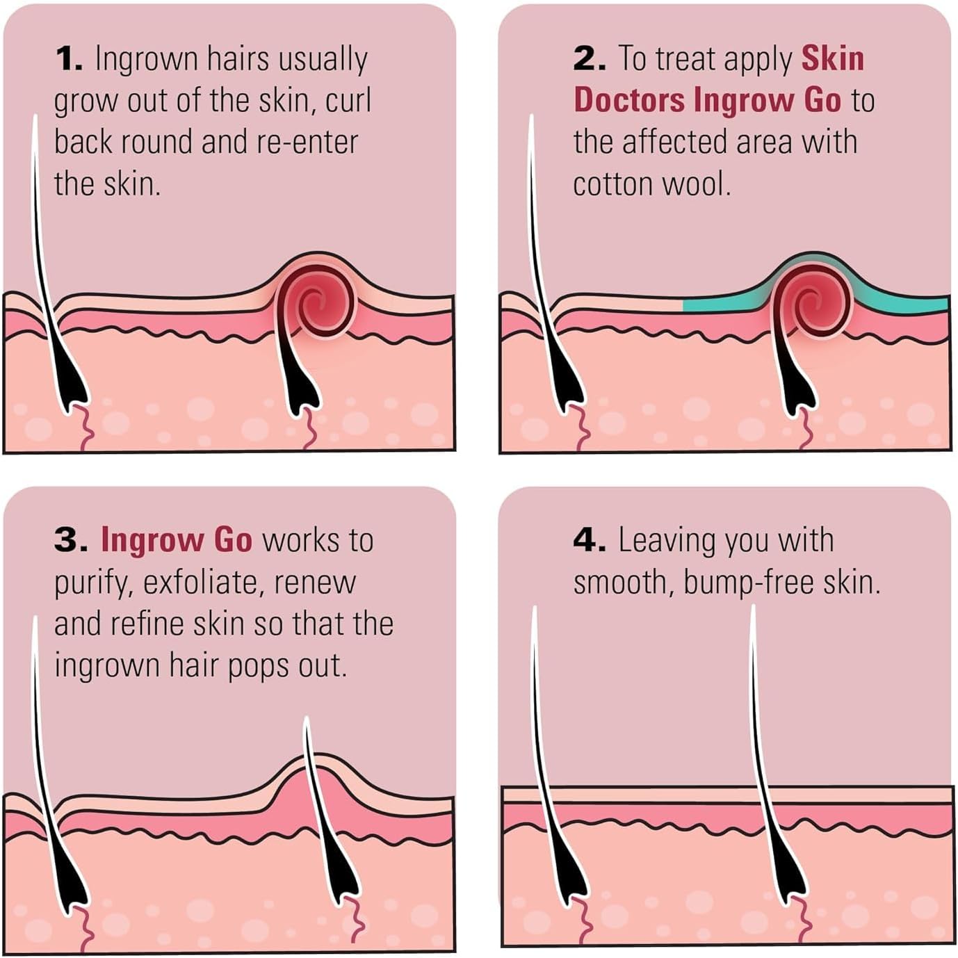 Skin Doctors Ingrow Go ingrown hair lotion application instructions bottle 120ml