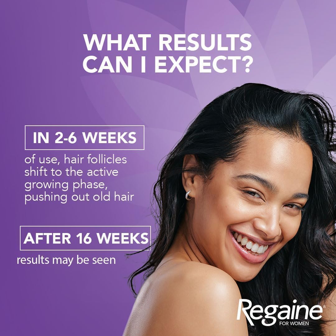 Regaine for Women Regular Strength 2% Minoxidil Scalp Solution – 60mlv
